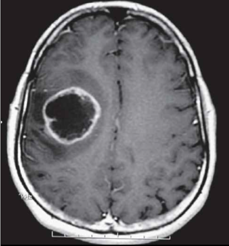 Leseprobe WissenSchafftPlus Ausgabe 4/2018
